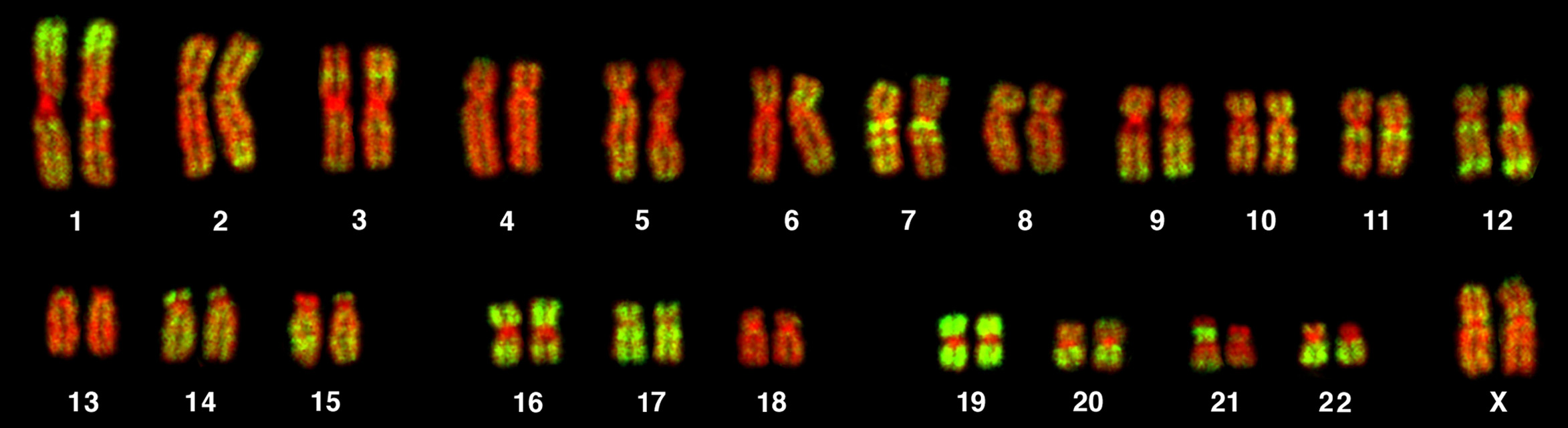 Most of the content of our chromosomes may simply function as a protective mechanisms against rogue mutations. Credit: Andreas Bolzer, Gregor Kreth, Irina Solovei, Daniela Koehler, Kaan Saracoglu, Christine Fauth, Stefan Müller, Roland Eils, Christoph Cremer, Michael R. Speicher, Thomas Cremer, via Wikimedia Commons