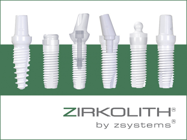 Where can you get free dental implants?