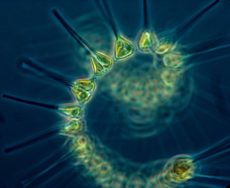 Phytoplankton - the foundation of the oceanic food chain. Image credit: NOAA MESA Project.
