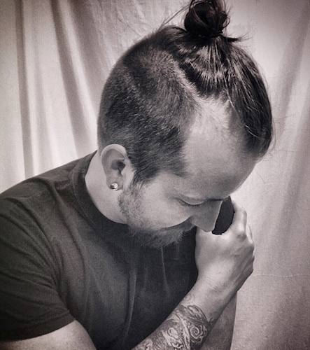 A-photograph-of-a-balding-guy-with-a-man-bun-hairstyle-and-a-Norwood-3-hair-loss-stage.jpg