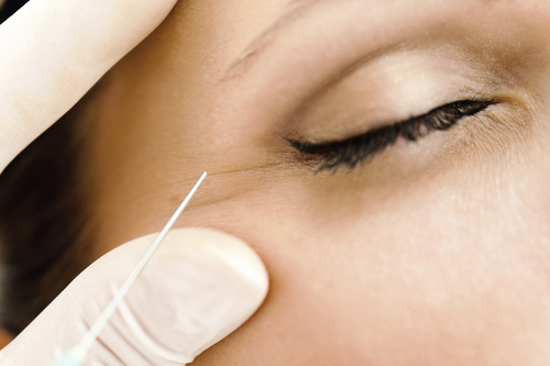 Anti-Wrinkle Injections The Aesthetic Clinic