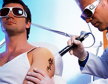 Tattoo Removal The Aesthetic Clinic