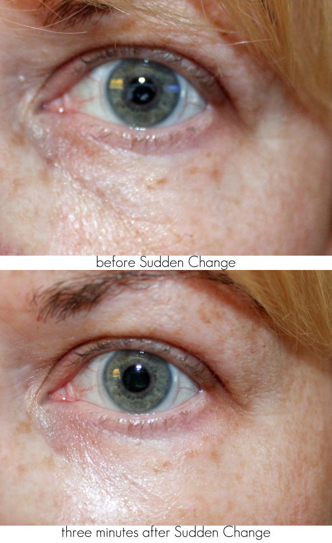 Sudden Change Under-Eye Firming Serum Before + After