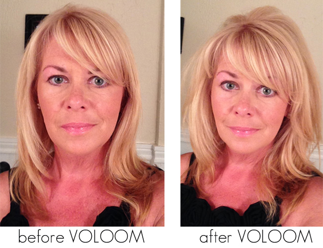 VOLOOM Hair Volumizing Iron Before and After