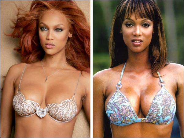 breast implants — Body Beat Sexy Fashion Stories