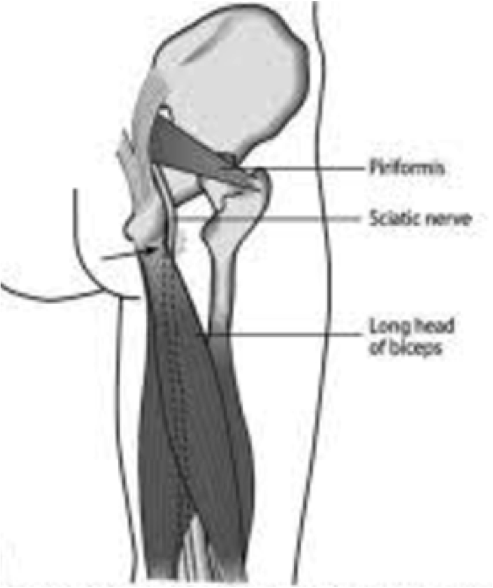 Hamstring Tendonitis or Hamstring Syndrome — Zion Physical Therapy