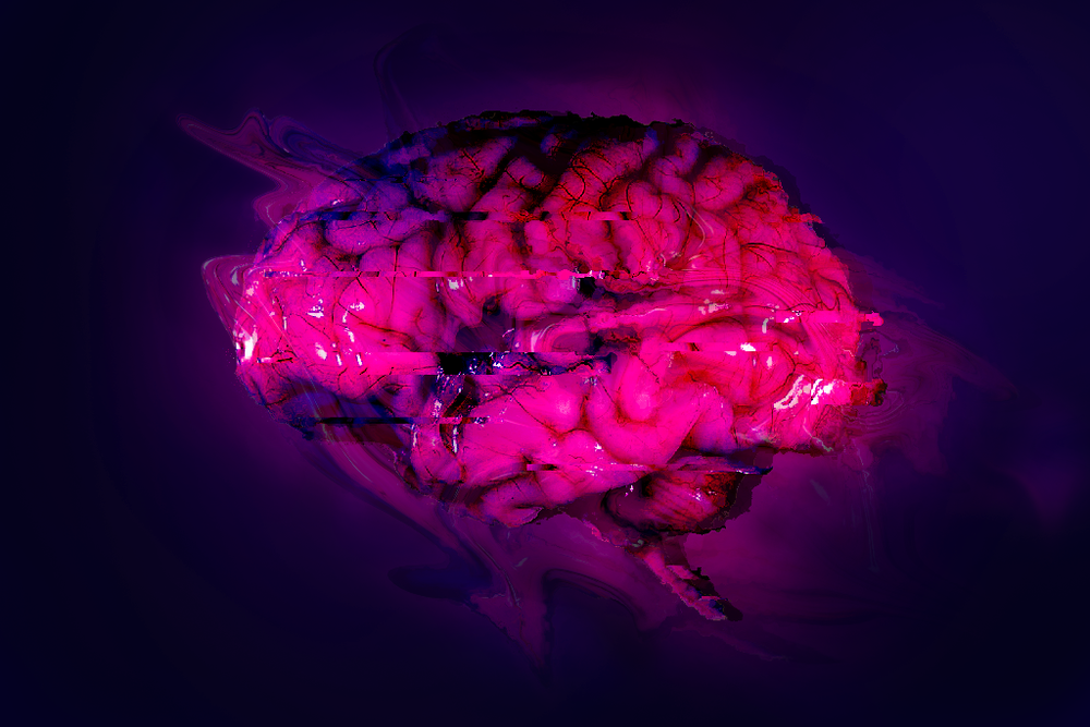 Traumatic Brain Injury - July 2018