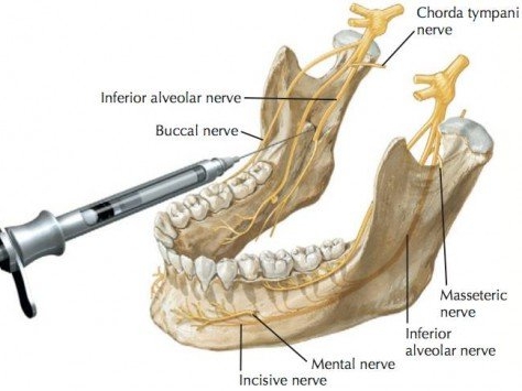 Inferior Alveolar Nerve Block Distribution