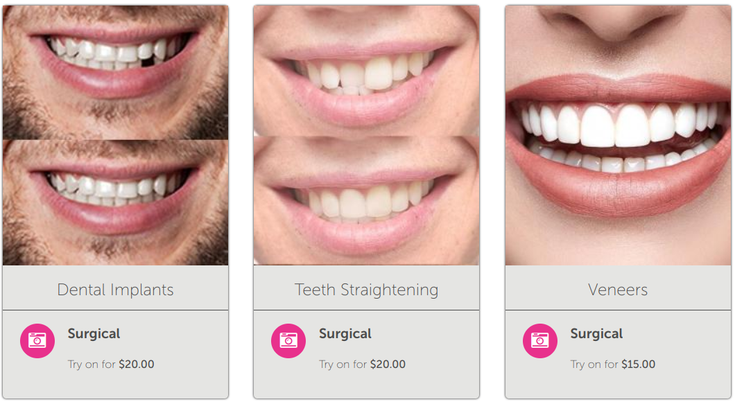 New Look Now Smile Simulations 