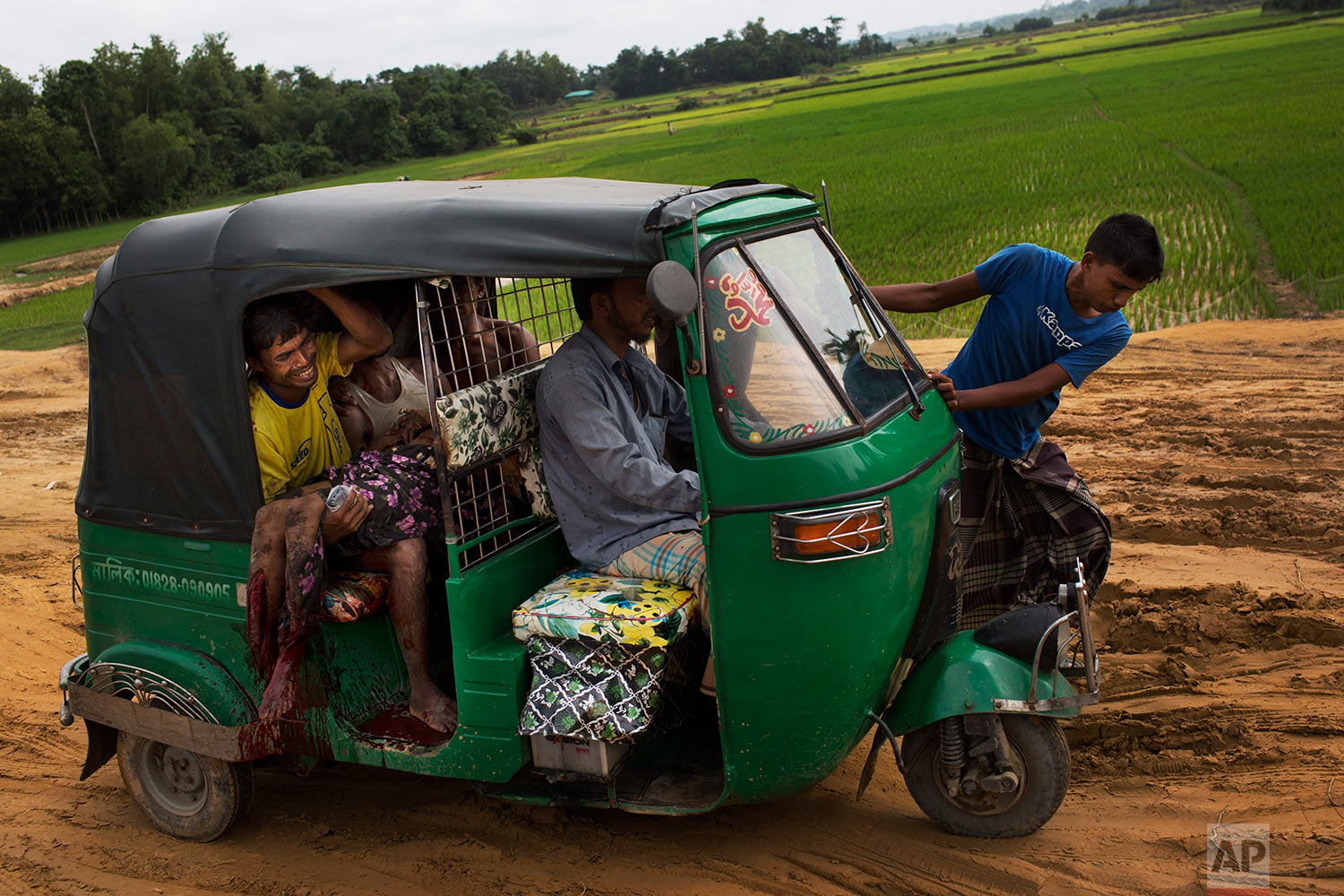 EDS NOTE GRAPHIC CONTENT: An injured elderly woman and her relatives rush to a hospital on an autorickshaw, near the border town of Kutupalong, Bangladesh, Monday, Sept. 4, 2017. The Rohingya woman encountered a landmine that blew off the right leg while trying to cross into Bangladesh. (AP Photo/Bernat Armangue)