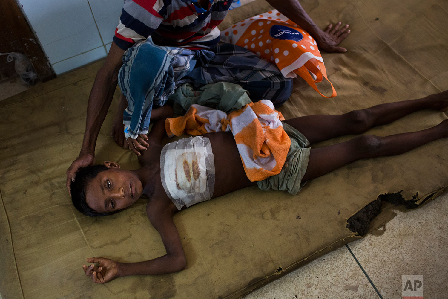 Shoabib, 7, lies on the floor next to his father at Sadar Hospital in Cox's Bazar, Bangladesh, Sunday, Sept. 10, 2017. (AP Photo/Bernat Armangue)