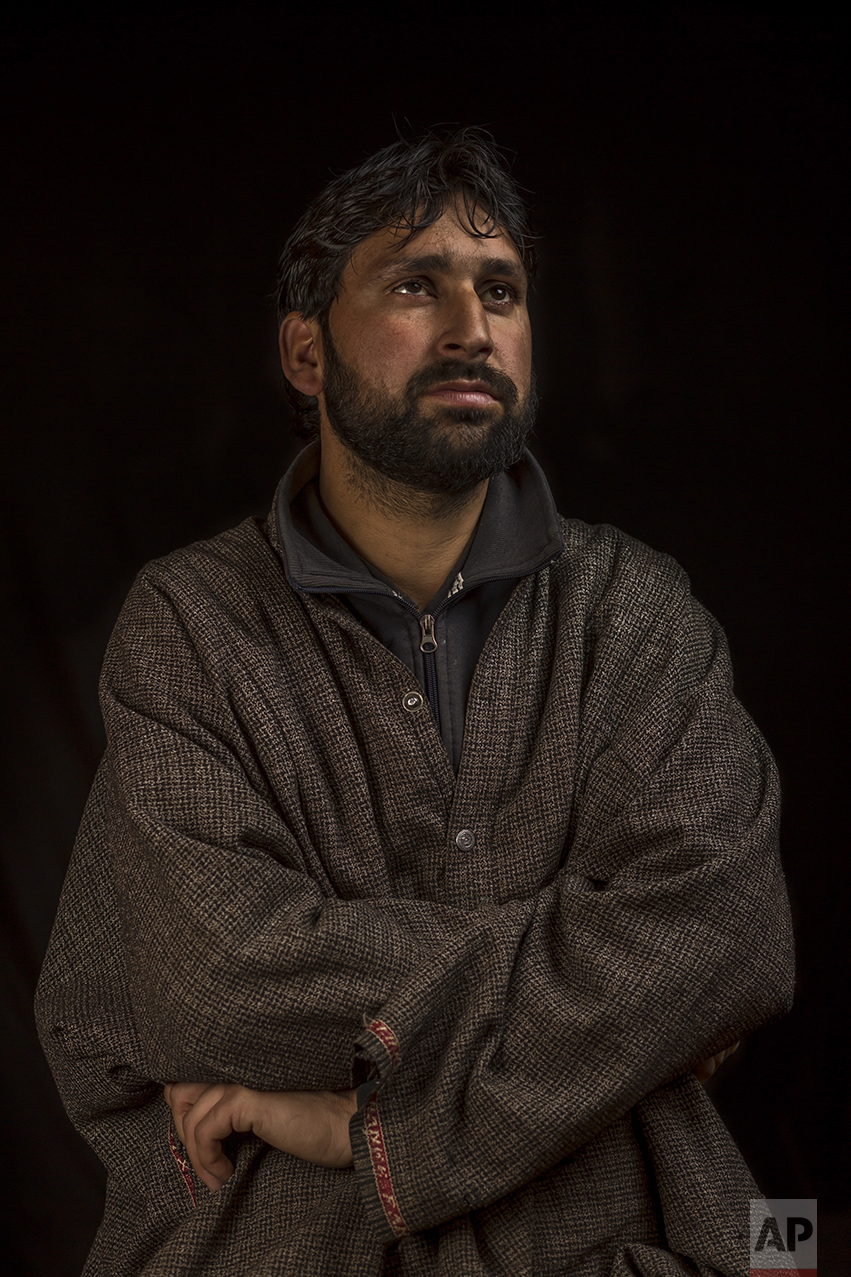 In this Nov. 29, 2016 photo, Abbas Ahmad Pandit poses for a portrait in the village of Karimabad, Indian-controlled Kashmir. Pandit's right eye got severely damaged by pellet injuries during clashes with Indian security forces. Indian authorities began using shotguns for crowd control in Indian-controlled Kashmir in 2010, calling them “non-lethal” weapons that could control massive crowds of stone-throwing protests. (AP Photo/Bernat Armangue)