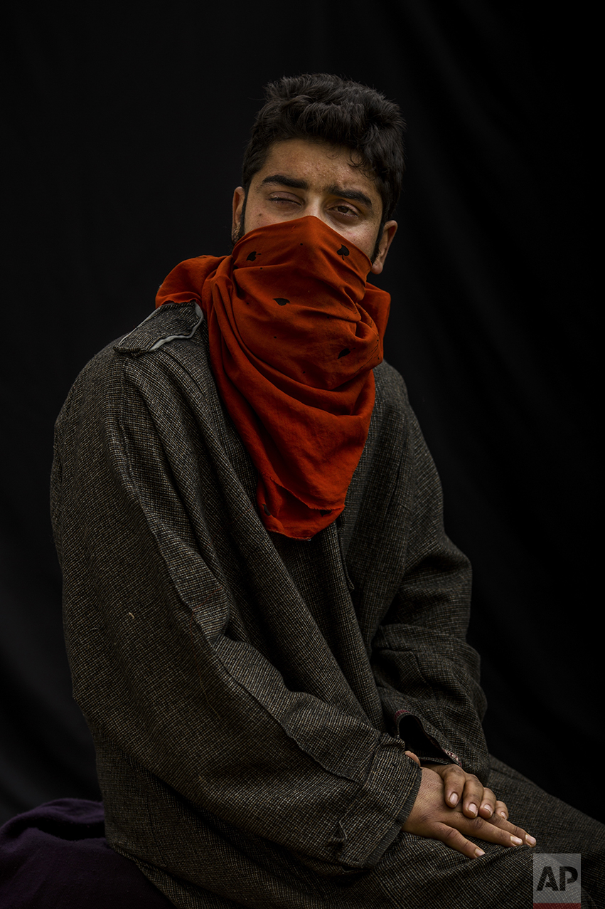 In this Nov. 30, 2016 photo, Tanveer poses for a portrait with his face partially covered, near Baramulla, Indian-controlled Kashmir. Tanveer lost eyesight on his right eye because metal pellet injuries. "I was an earning hand of my family. I feel like a living dead." he says. Health officials say that in the past five months more than 6,000 people, mostly young men, have been injured by shotgun pellets, including hundreds blinded in one or both eyes.  (AP Photo/Bernat Armangue)