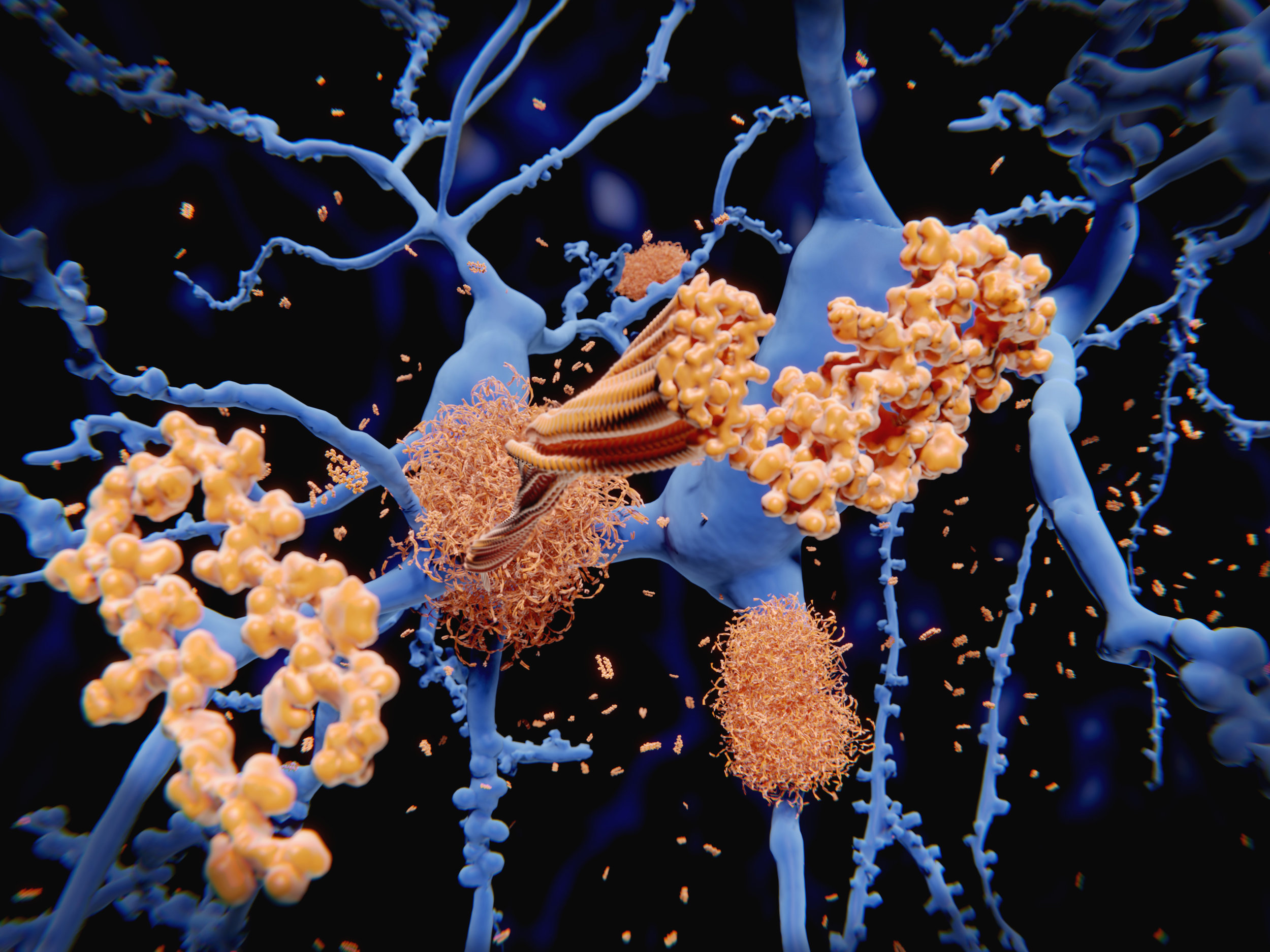 Nanotechnology shown to inhibit development of Alzheimer's disease
