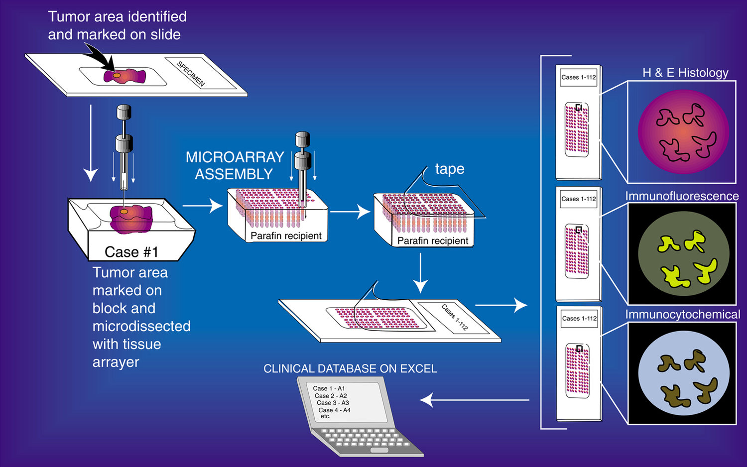 How to Construct Tissue Microarrays