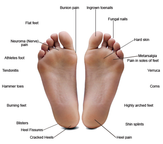 Common Foot Problems — Hawaii Podiatry