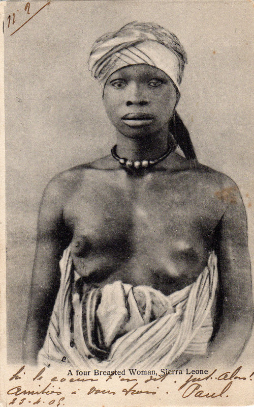 A four-breasted woman, Sierra Leone, 1909.