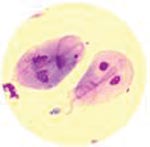 can giardia be found in well water