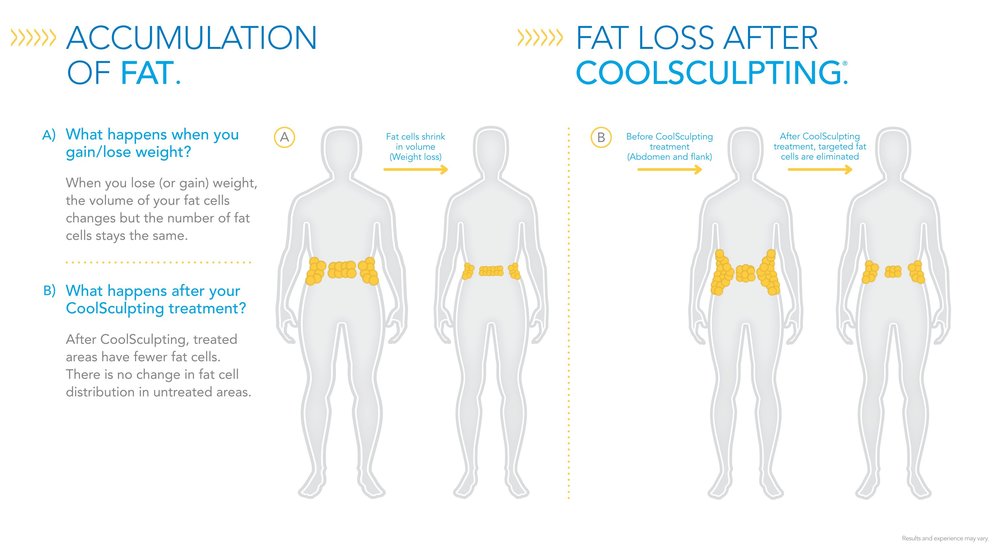 Aculation Of Fat Loss After Coolsculpting1 Jpg