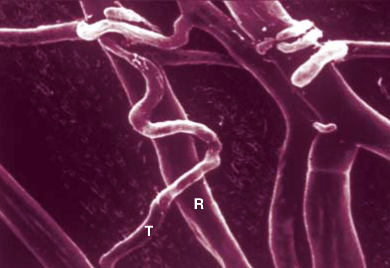   Rhizoctonia solani  (R) being attacked by  Trichoderma  (T). &nbsp; &nbsp; Harman et al. 2004 .&nbsp; 