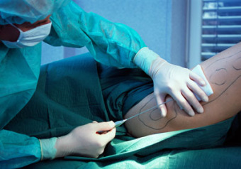 Laser Assisted Liposuction - Medical Spa MD
