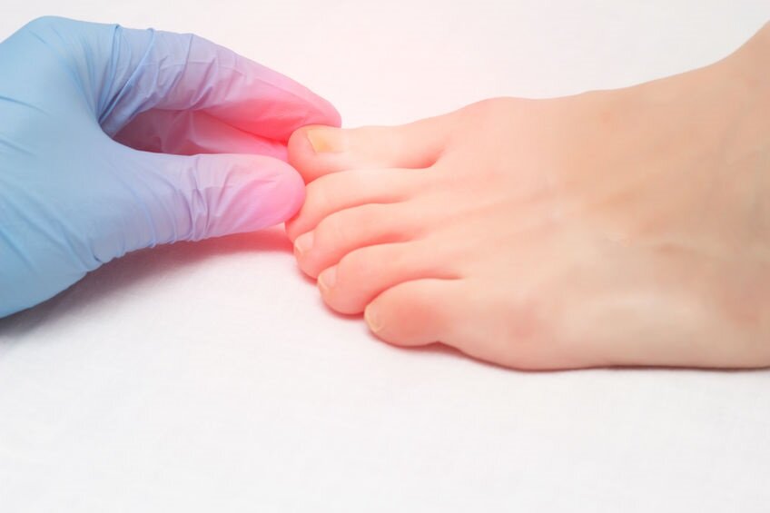 3 Primary Causes of Big Toe Pain — Fit Feet For Life