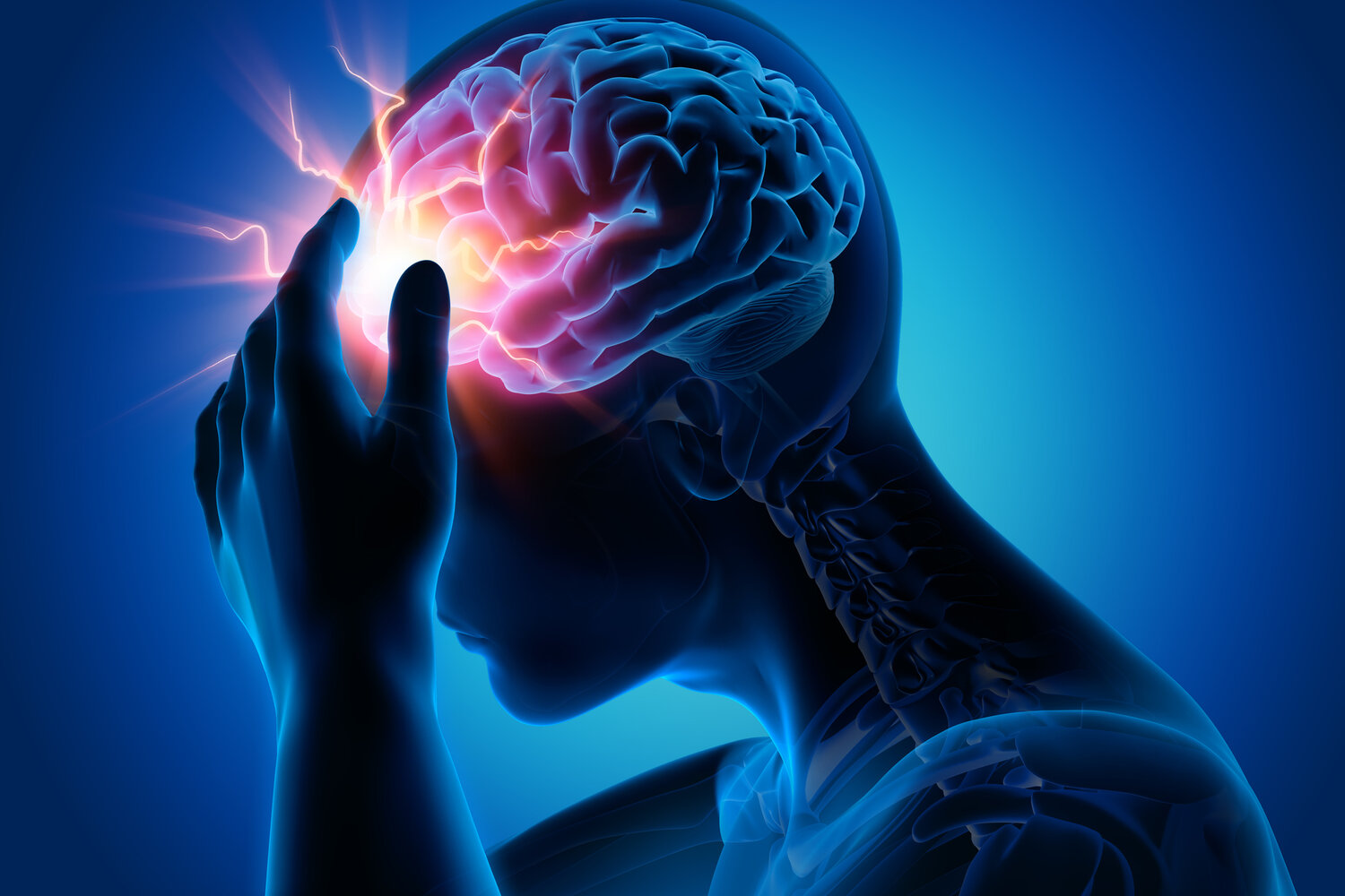 Headaches — Concussion Alliance