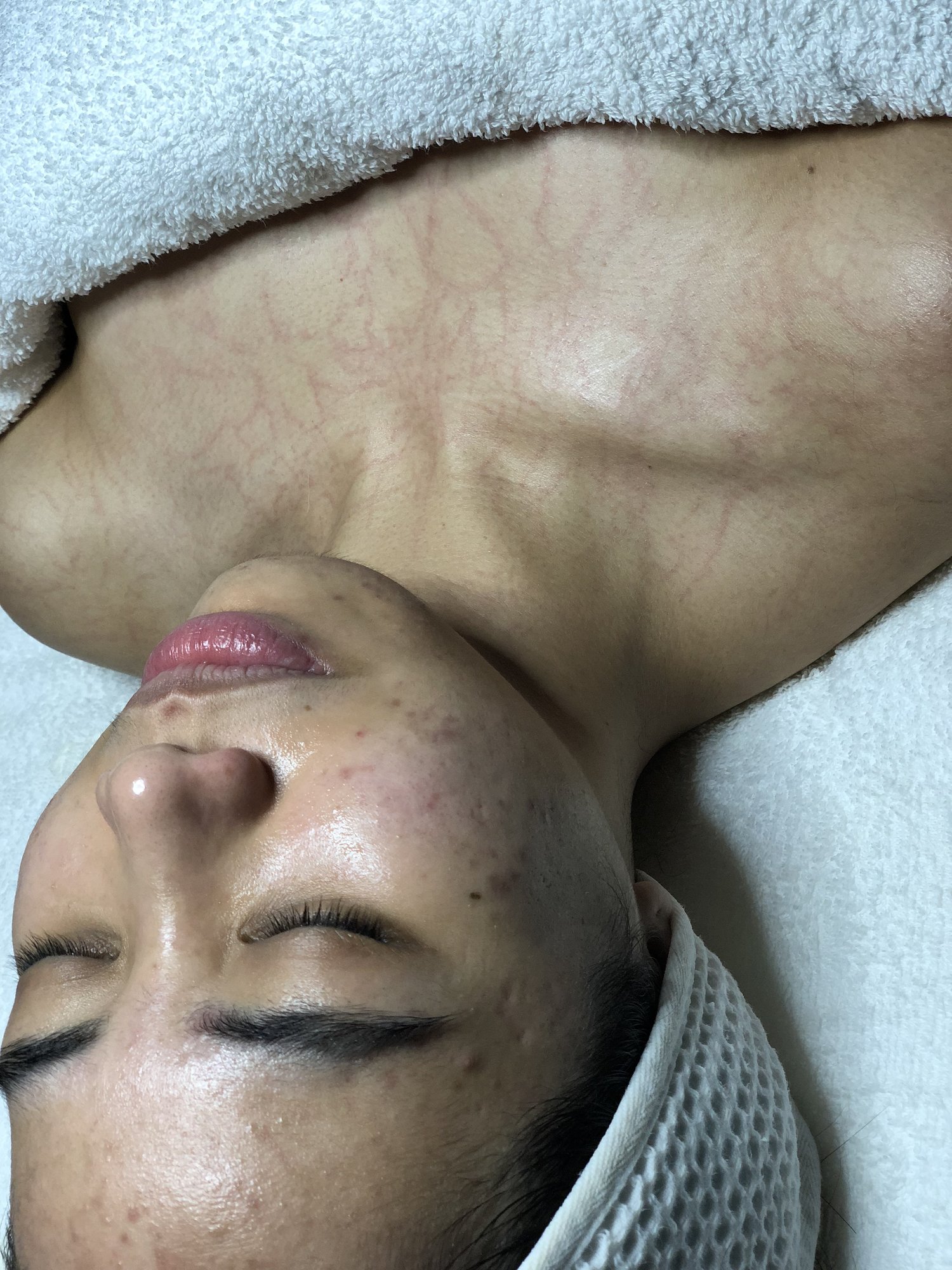 DMK Enzyme Therapy — With Grace Skin Management