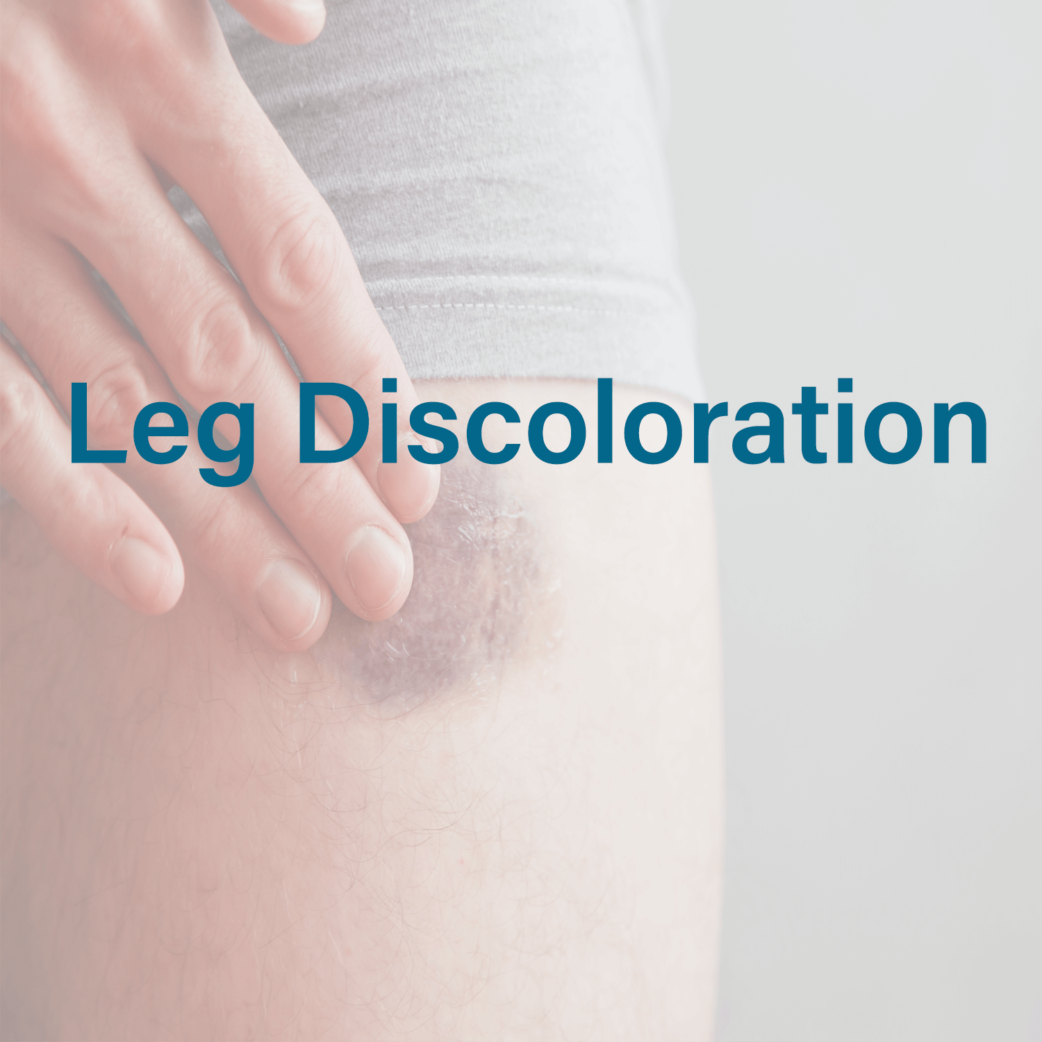 Leg Discoloration