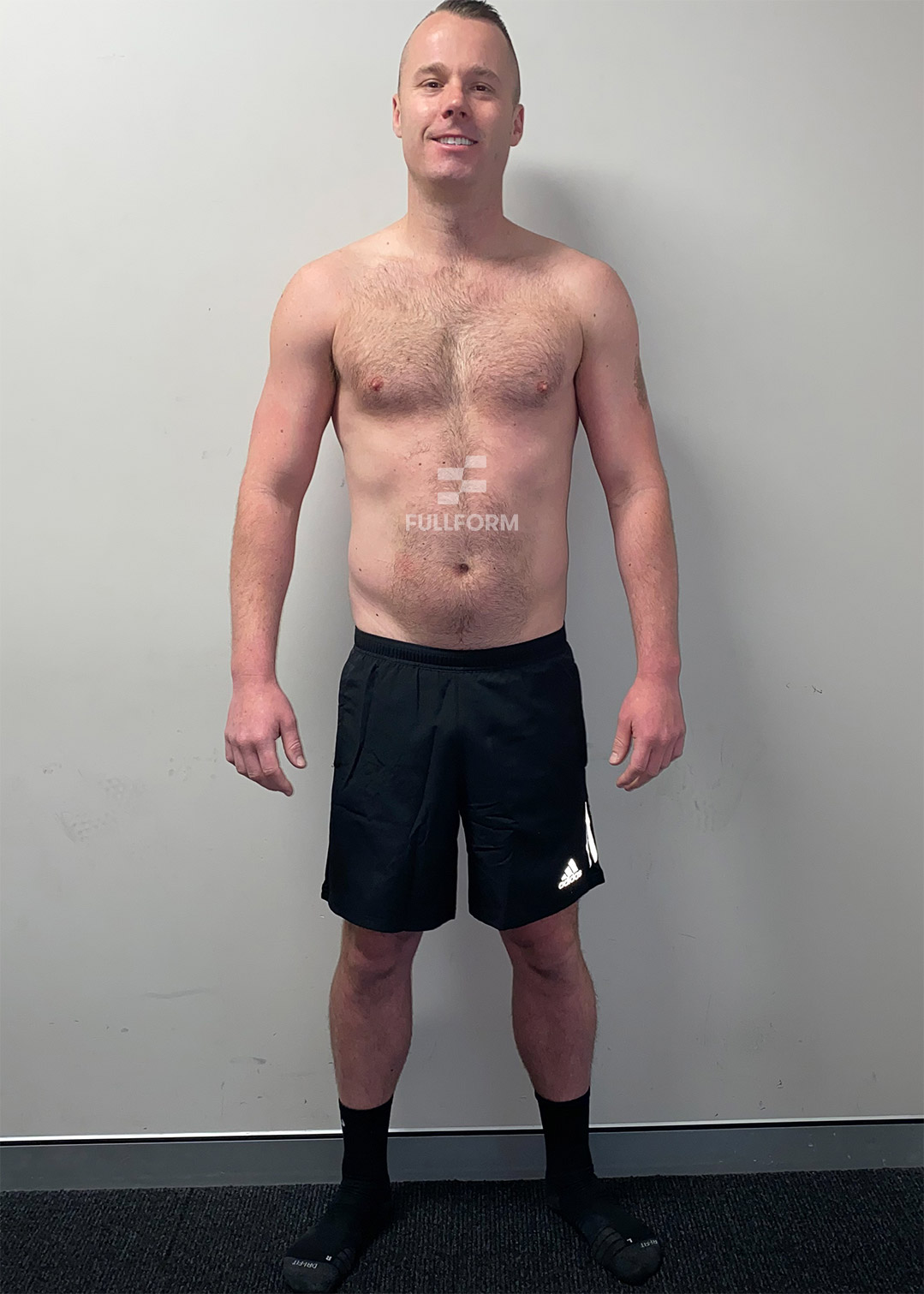 BEFORE FULLFORM FITNESS